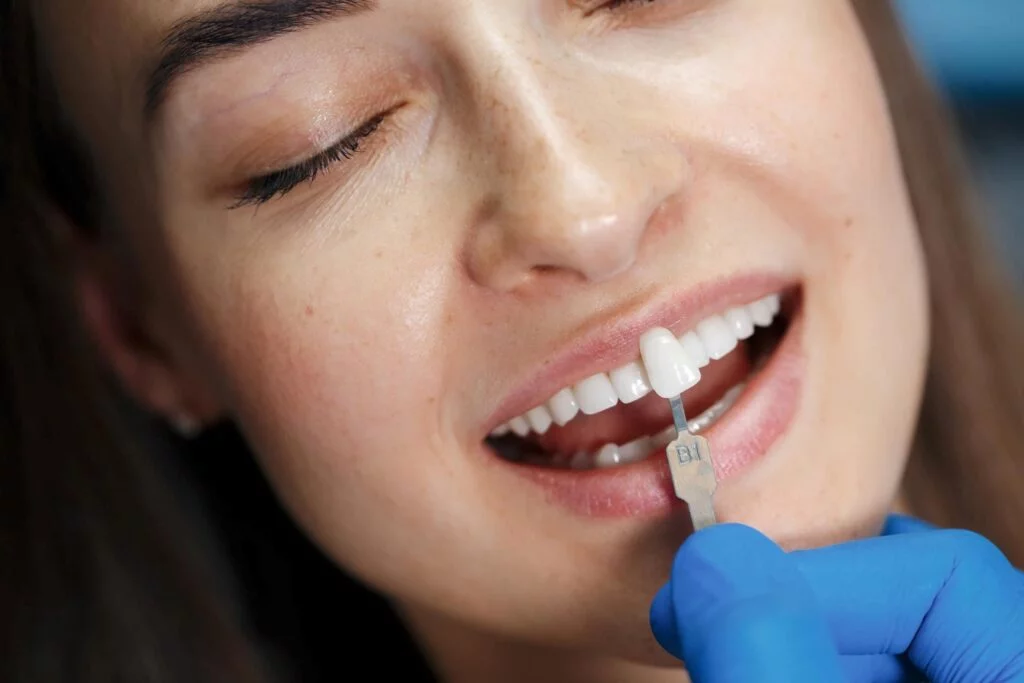 Une femme qui se fait poser une facette sur ses dents de devant