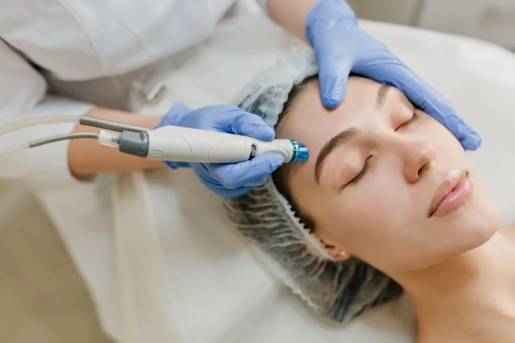 Le microneedling est une technique de soin pour rajeunir la peau en réduisant notamment les problèmes d'acné